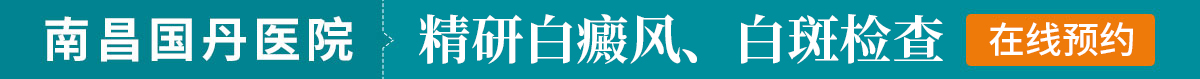 南昌白癜风医院