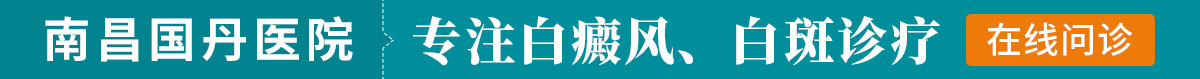 南昌白癜风医院